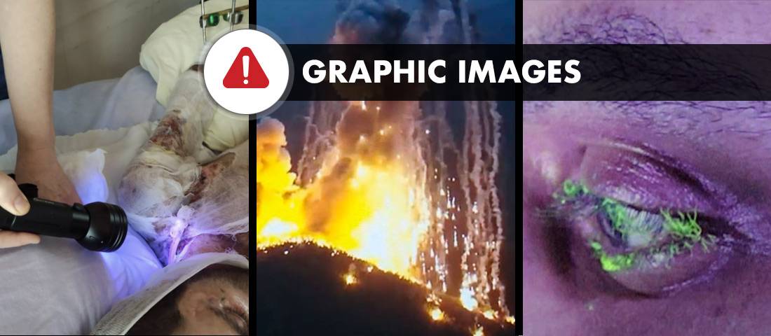 The humanitarian toll of Azerbaijani scorched-earth strategy in Artsakh/ Nagorno-Karabakh: White Phosphorus, devastated nature and non-healing  wounds - AzeriWarCrimes.ORG