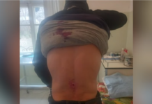 Daily organized aggression of Azerbaijani troops against peaceful Artsakh residents #2